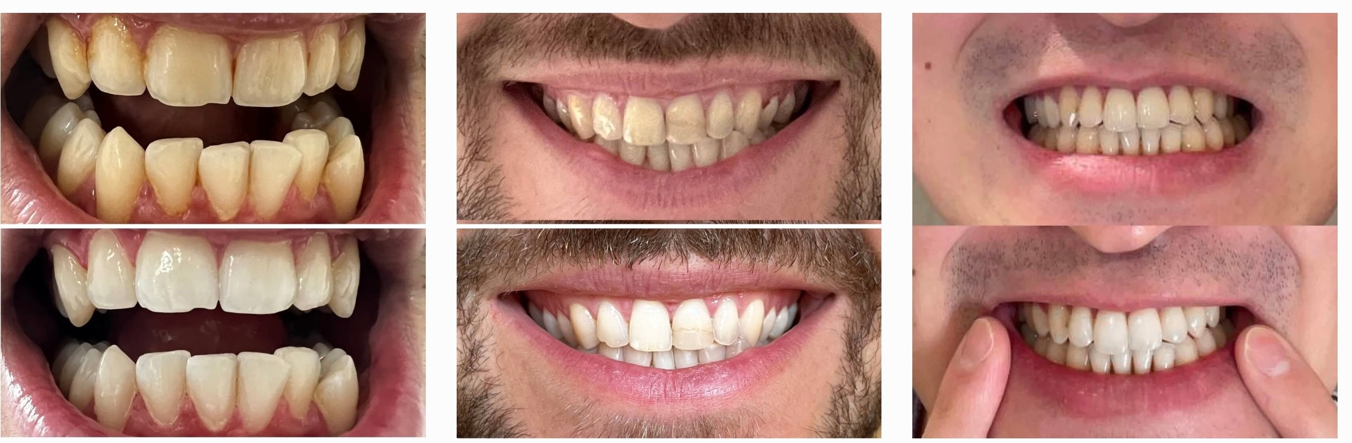 Natural Enamel-Safe Formula for Bright Smile